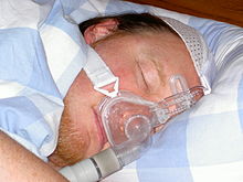 sleep apnea cpap